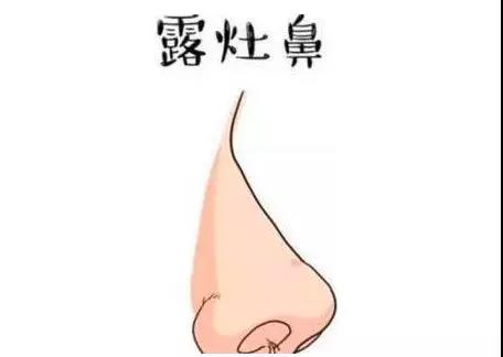 鼻子